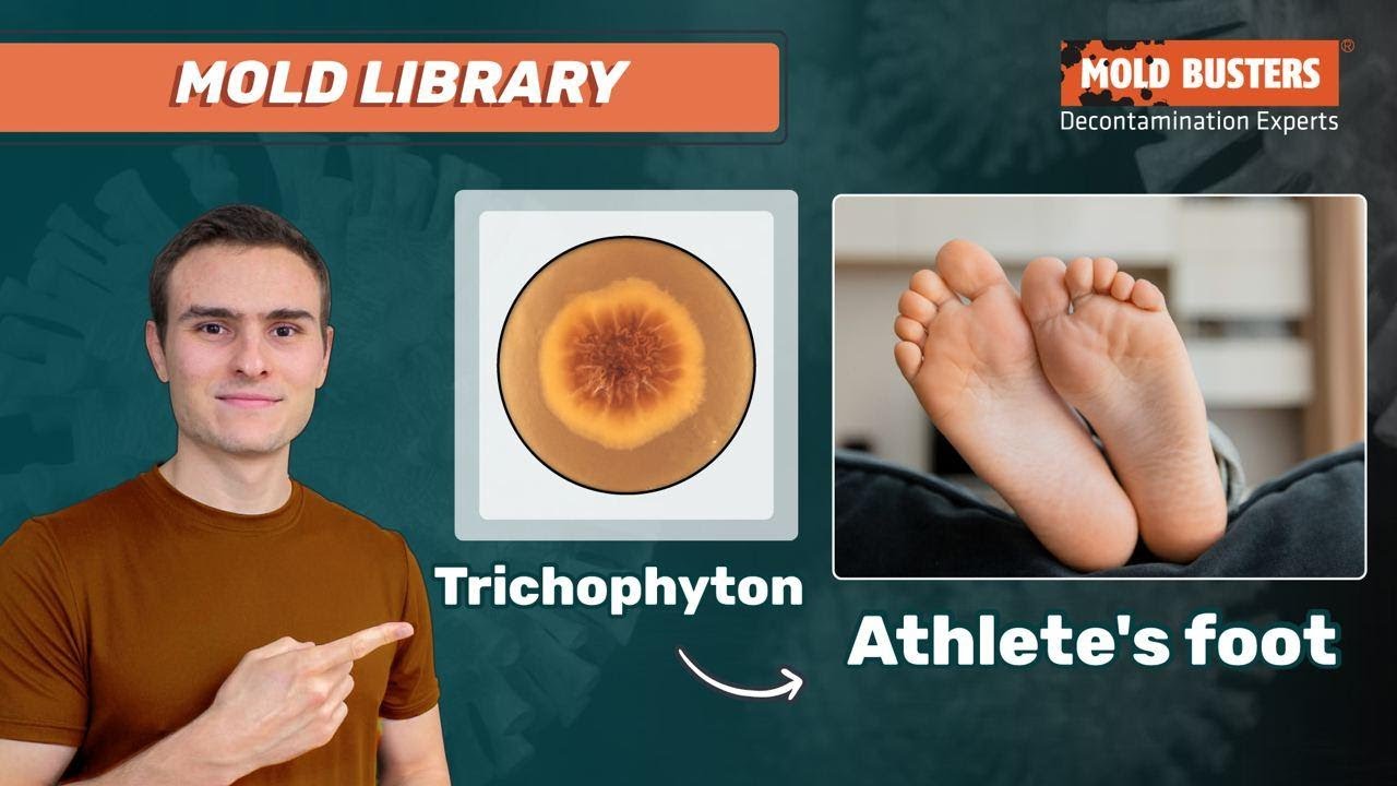 a) 68-year-old female patient, before treatment. Trichophyton rubrum... |  Download Scientific Diagram