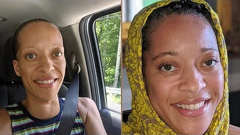 Update - Hyperthyroid/Graves Disease.. I was sick and skinny, how I recovered