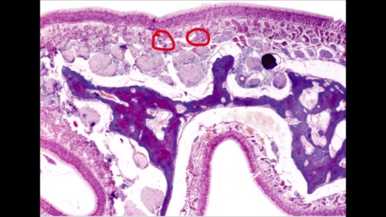 MUCOSA NASAL (LAB. DE HISTOLOGÍA) YouTube