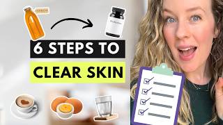 How to clear acne naturally in 3 months - my 6 step checklist