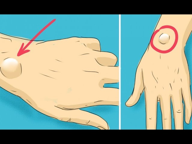 Вот почему у некоторых людей есть эта шишка на запястье!