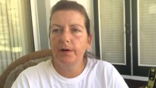 My Efudex 21 Day Treatment