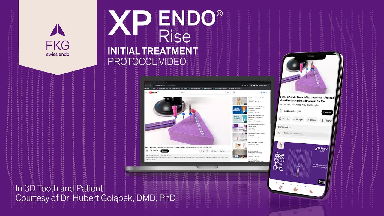 FKG XPendo Rise Initial treatment Protocol video illustrating