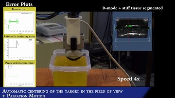 Robot-assisted 3D ultrasound elastography