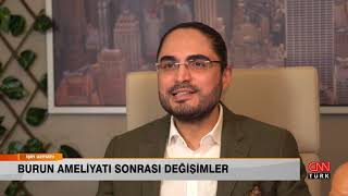 Burun Estetiği Ameliyatı Sonrası Değişimler Op Dr Berkan Arik