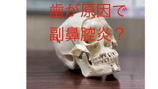 【歯科用CT】【副鼻腔炎】【上顎洞炎】