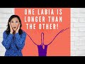 WHY DOES ONE LABIA HANG OUT MORE THAN THE OTHER?? - Girl Talk with Dr. Rejuvenation