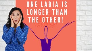 WHY DOES ONE LABIA HANG OUT MORE THAN THE OTHER?? - Girl Talk with Dr. Rejuvenation