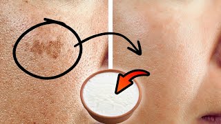 How I ERASED my age spots with a CHEAP kitchen ingredient by Natural Cures 248,775 views 4 weeks ago 5 minutes, 55 seconds