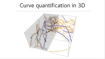 I2K 2022 Eugene Katrukha "Extracting curvilinear structures from large datasets using BigTrace"