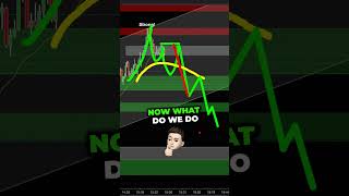 Download Lagu Use MOVING Average to find more WINNING Trades ... Joseph James💰 #trading MP3