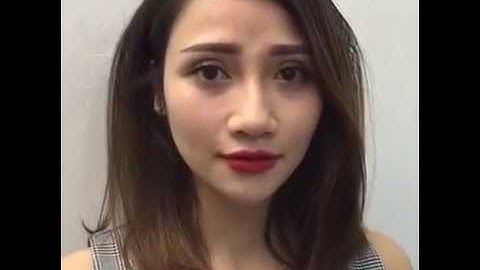 Tận Mắt Xem Kết Quả Cắt Mí Mắt Mini Deep Sau 7 Ngày