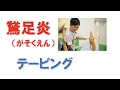 鵞足炎（がそくえん）テーピング【トータルボディケアこはる堂】
