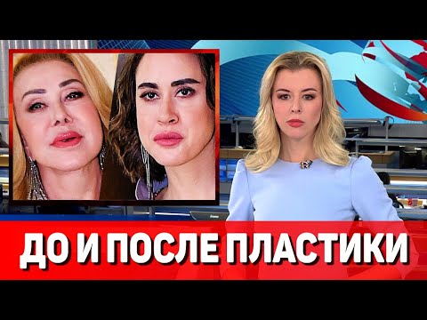 Дочь Успенской Татьяна Плаксина до и после пластики