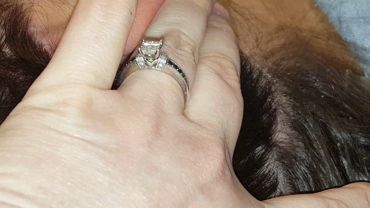 Part 1 psoriasis dandruff scalp scratching picking comb on my friend ASMR hair little talking