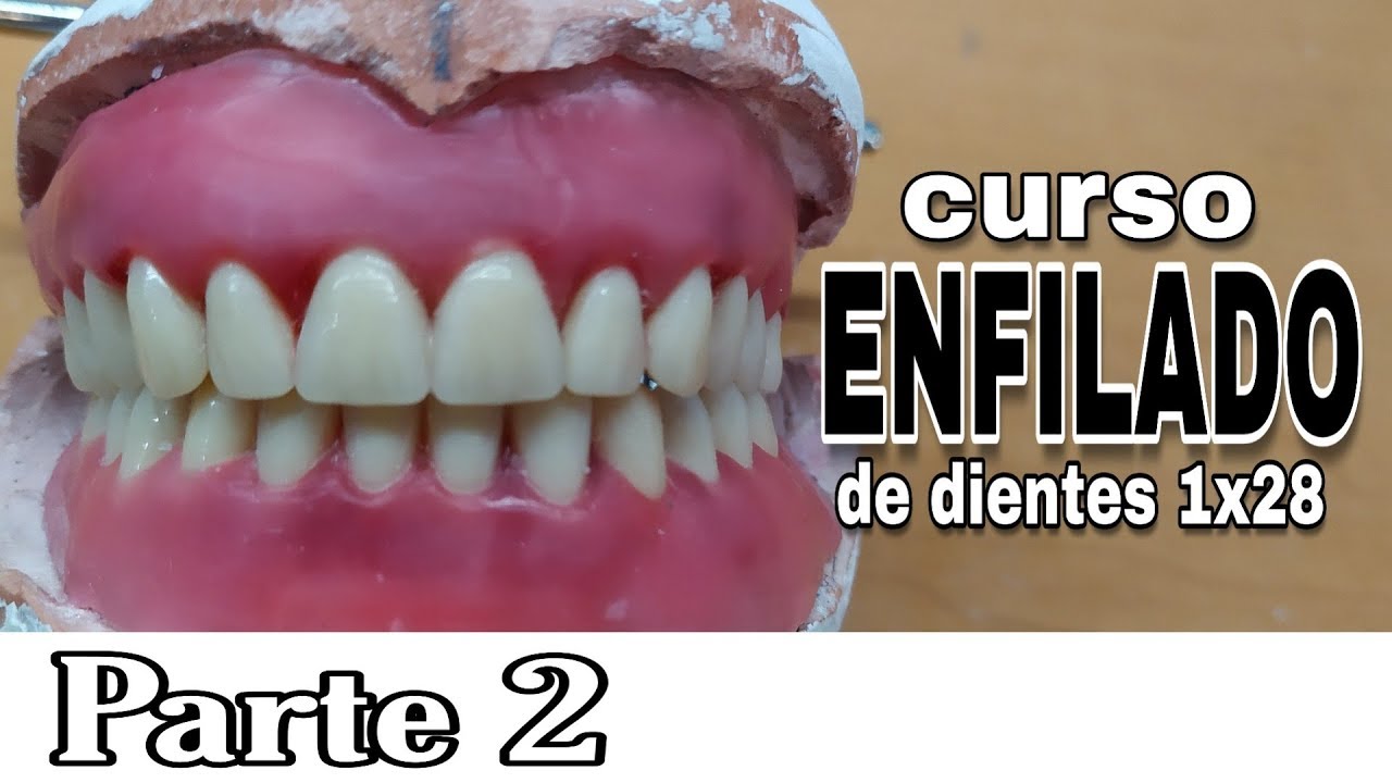 PRÓTESIS TOTAL ENFILADO o ARTICULADO DE DIENTES INFERIORES : Parte 2