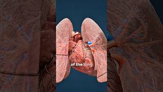 How a Blood Clot Makes it to the Lungs