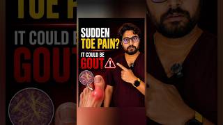 Is Your Toe Pain a Warning Sign of Gout? 😨 #shortsfeed #shorts