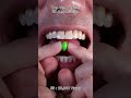 Satisfying Chewing ASMR #Compilation #ASMR #DoctorTristanPeh