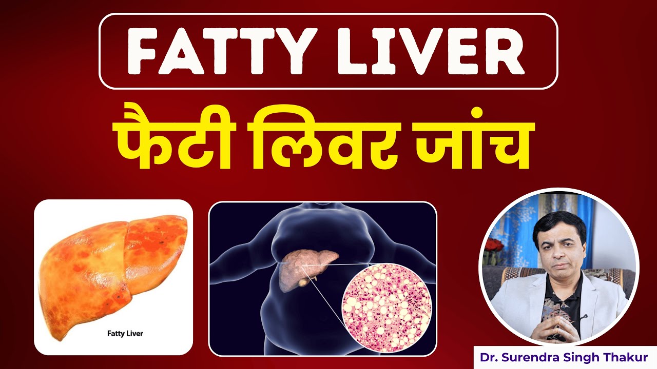 फैटी लिवर क्या होता है ? इसकी की पहचान कैसे होती है ? | Fatty Liver Diagnosis By Ultrasound Scan