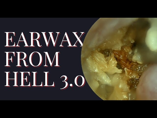 Earwax From HELL 3.0