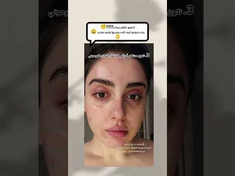 كيف بعتني ببشرتي حبوب هرمونية