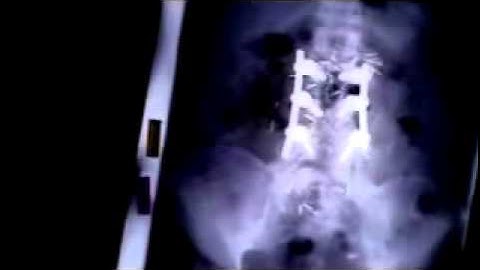 Introduction to EFT, Gary Craig