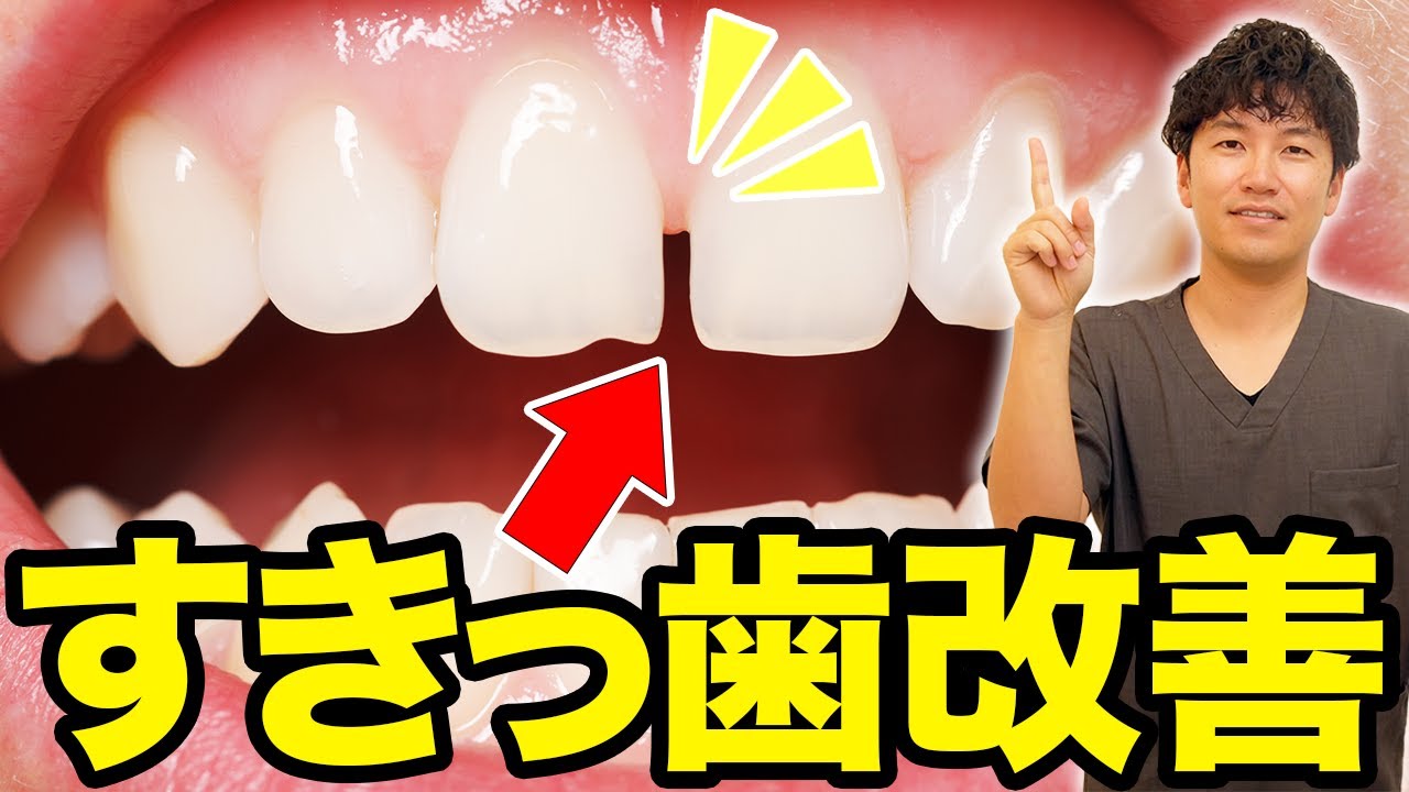 すき っ 歯 の 治し 方