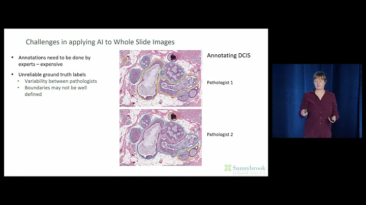 Artificial Intelligence And Digital Pathology: Making The Most of Limited Annotated Data