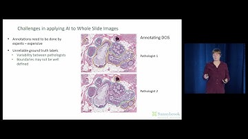 Artificial Intelligence And Digital Pathology: Making The Most of Limited Annotated Data