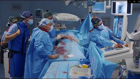 High-End 2D Imaging and Intraoperative 3D Stent Control with the Ziehm Vision RFD 3D