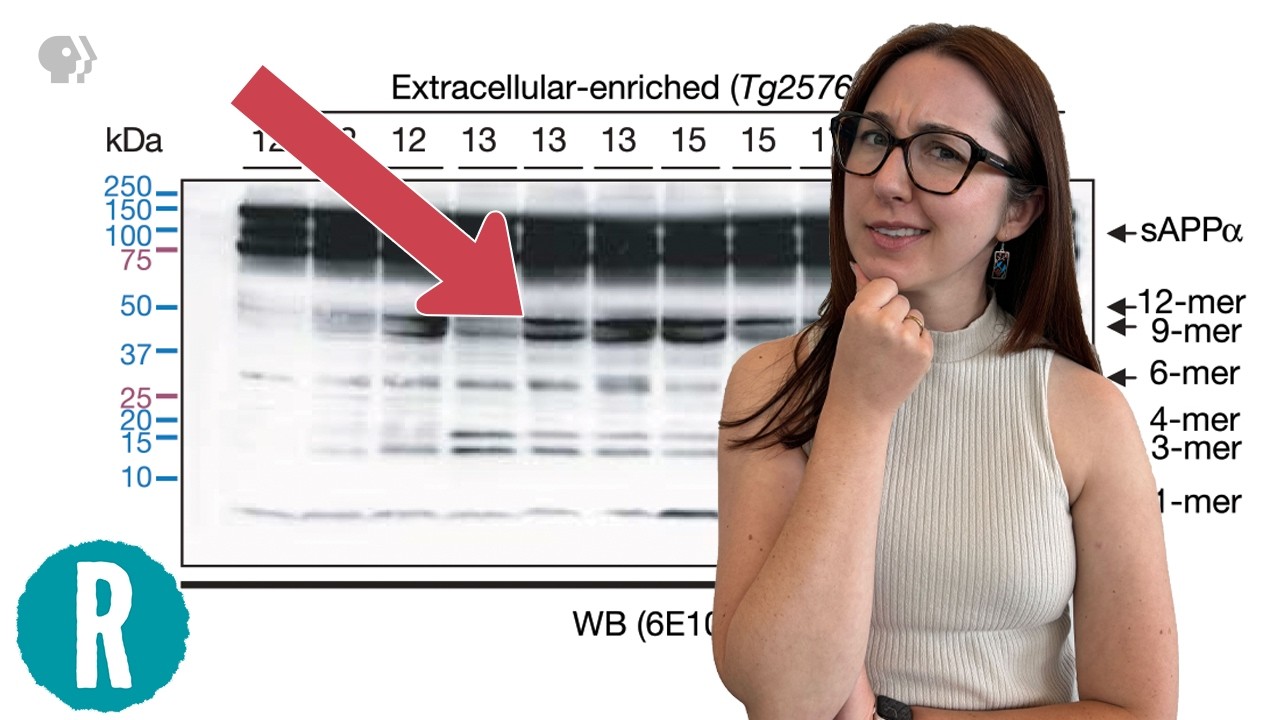 How a retracted paper affected the course of Alzheimer's research | Reactions Science Videos