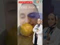 افضل و الاكثر امانا فى تمارين مفصل الركبة و علاج الخشونة للمسنين تمارين فالبيت خشونة الركبة علاج 