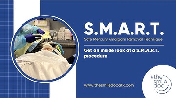 Behind the Scenes of the Safe Metal Amalgam Removal Technique at #thesmiledoc