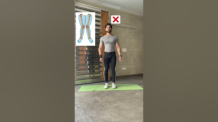 Knock knee Workout | Saurabh Fitness | #youtubeshorts #shorts