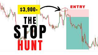 This Gold Trade Tested My Patience