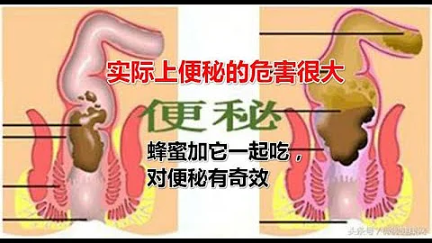 蜂蜜加它一起吃，对便秘有奇效，效果显而易见，不信你试试 - 天天要闻