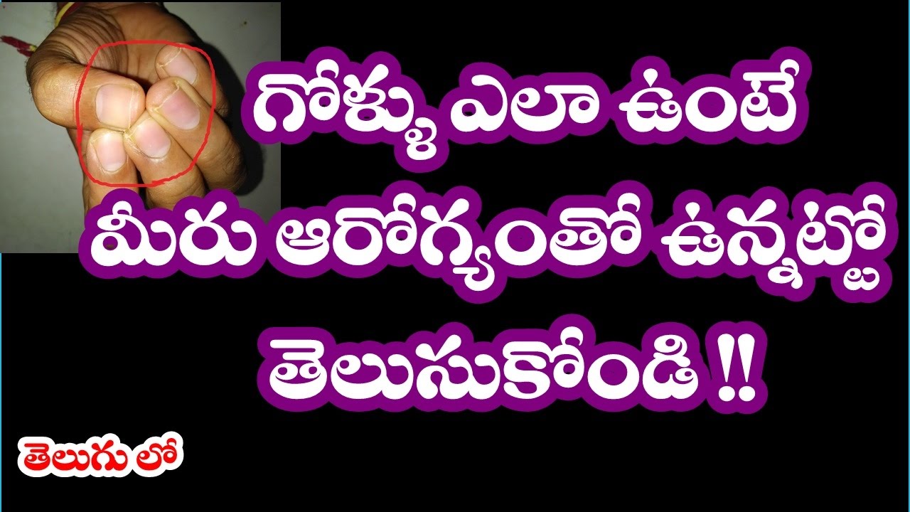 Your Nails(గోళ్ళు)Color and Texture Say About Your Health in telugu II
