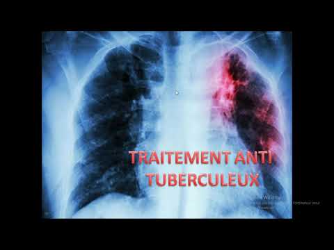 Vidéo: Lutte Contre La Tuberculose Pharmacorésistante En Chine: Progrès Et Défis