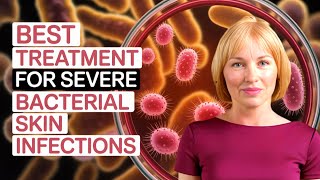 What is DALBAVANCIN? (Dalvance) BEST Treatment for Severe Bacterial Skin Infections