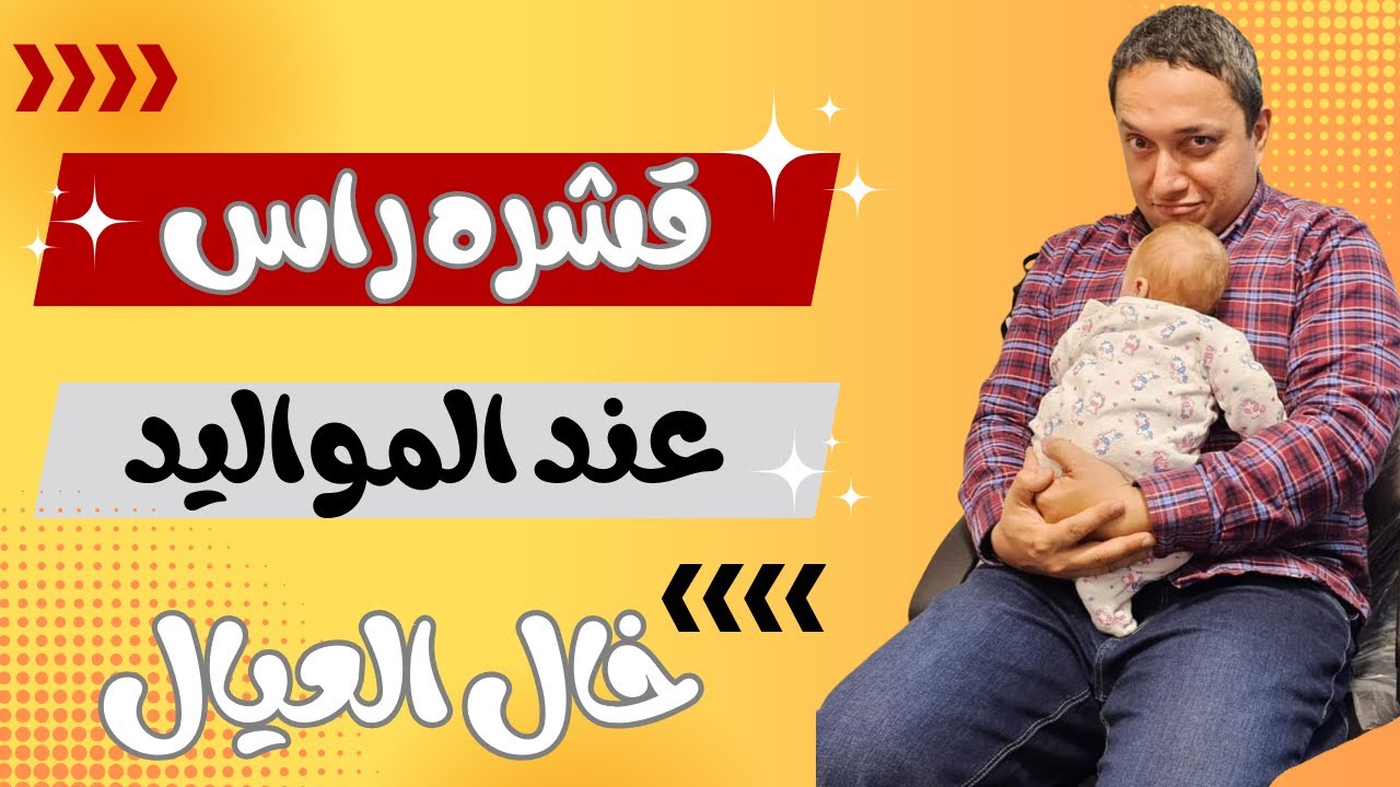 التعامل مع قشره الراس عند المواليد