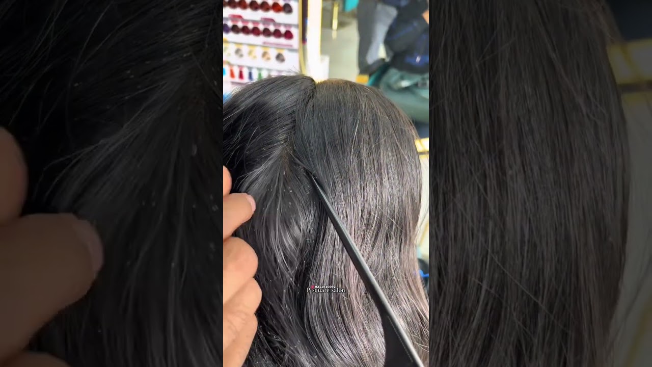 LICES AND NEETS HAIR 😱#lice #neets #p2salon #gauravnik