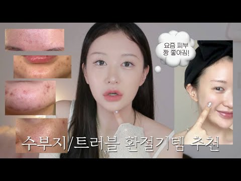 ✴︎ 요즘 피부 좋아진 &amp;#39;수부지/트러블&amp;#39; 인간의 환절기 <strong>스킨케어템</strong> 추천 ✴︎