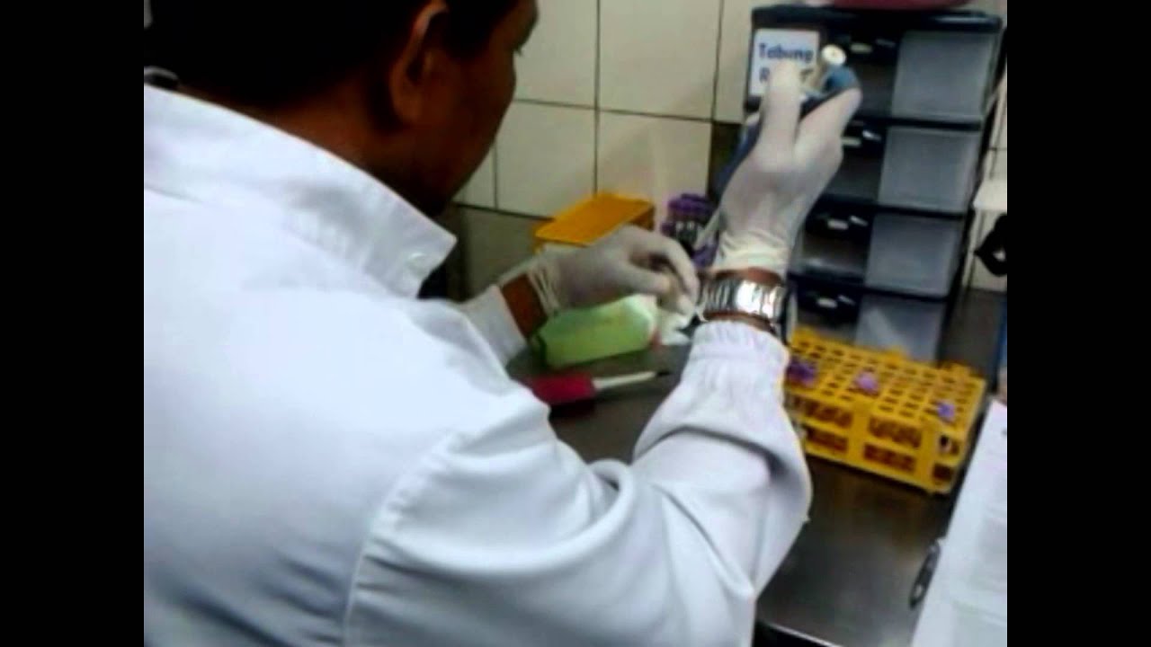 Imunohematology - Cross Match Test - YouTube