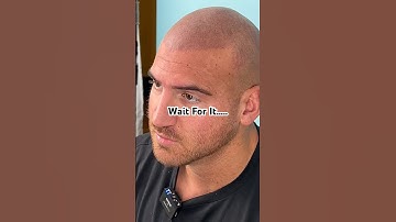 UNBELIEVABLE SMP #scalpmicropigmentation