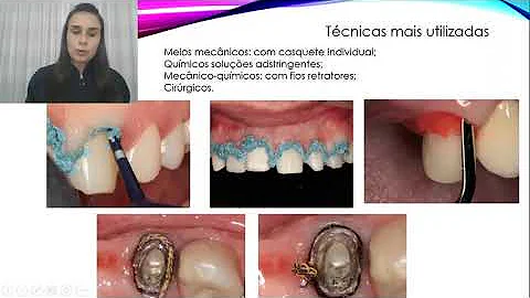 Quais os tipos de moldagem?