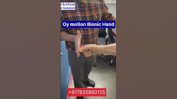 Nakli haat | robotic hand | Oy motion bionic hand | Functional hand | Prosthetic 🖐️ #armprosthesis