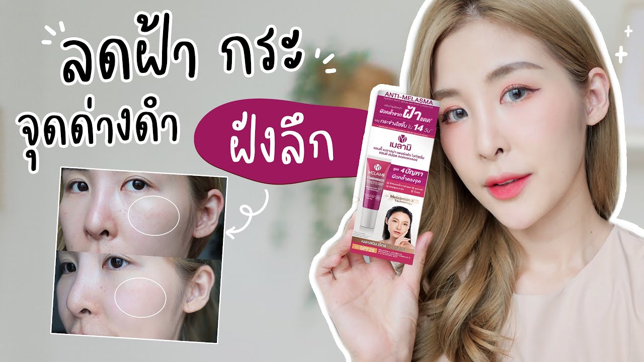 ครีม ยี่ห้อ ไหน ใช้ แล้ว หน้า ขาว  Update  7 วันทดสอบ ครีมทาฝ้า กระ จุดด่างดำฝังลึก เห็นผลแค่ไหน ไปดูกันนน