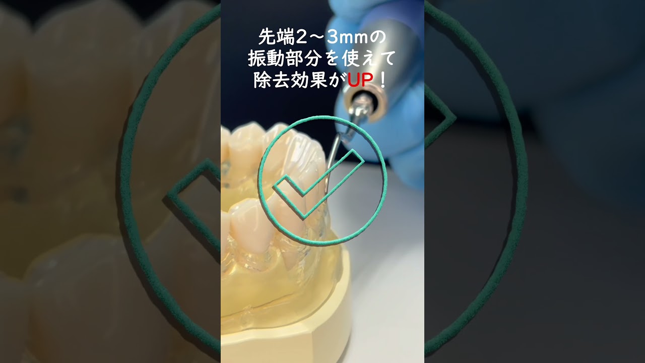 超音波チップ先端2〜3mmを歯面に沿わせるだけで効率アップ