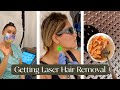 LASER HAIR REMOVAL! 100% PAINLESS?!?! VLOG (MY ACNE/SKIN JOURNEY)